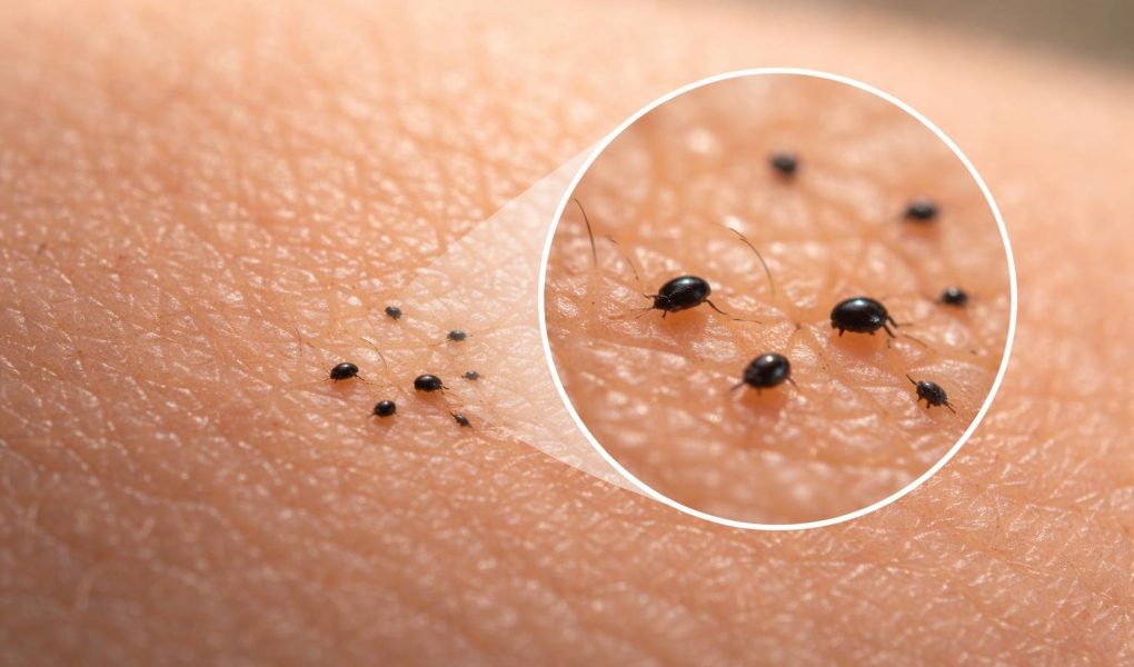 peau-humaine-creatures-noires-gros-plan